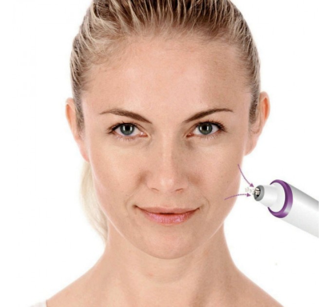 Прилад для чищення шкіри обличчя Beurer FC 76